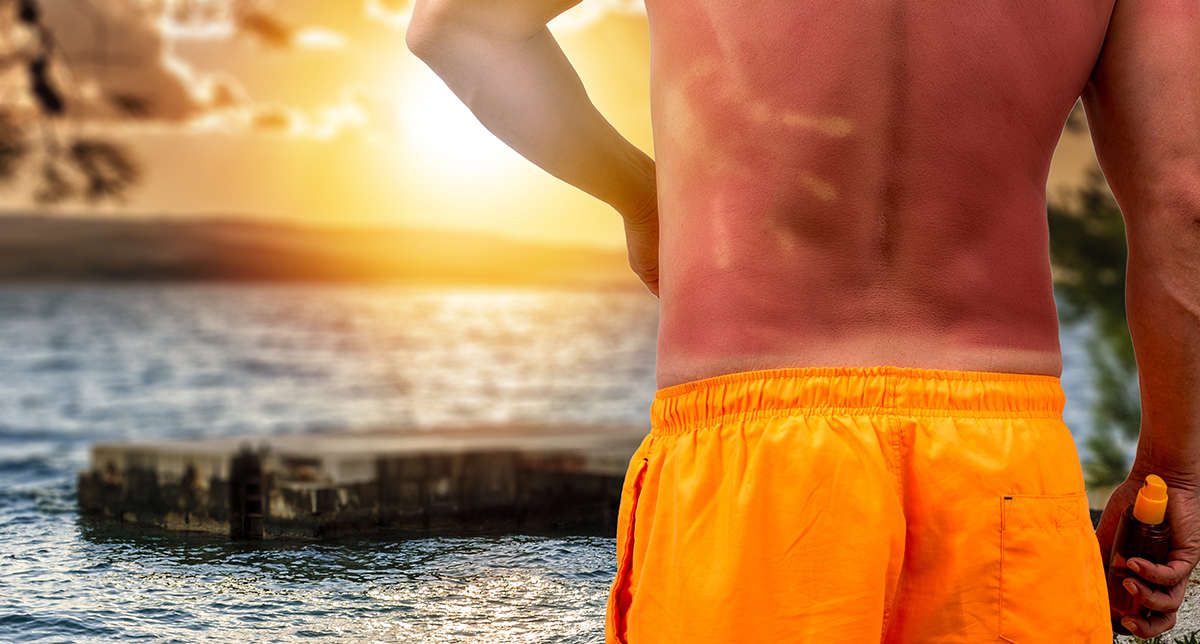 SANTÉ : INSOLATION : Aimer le soleil, oui! Mais jusqu’où?